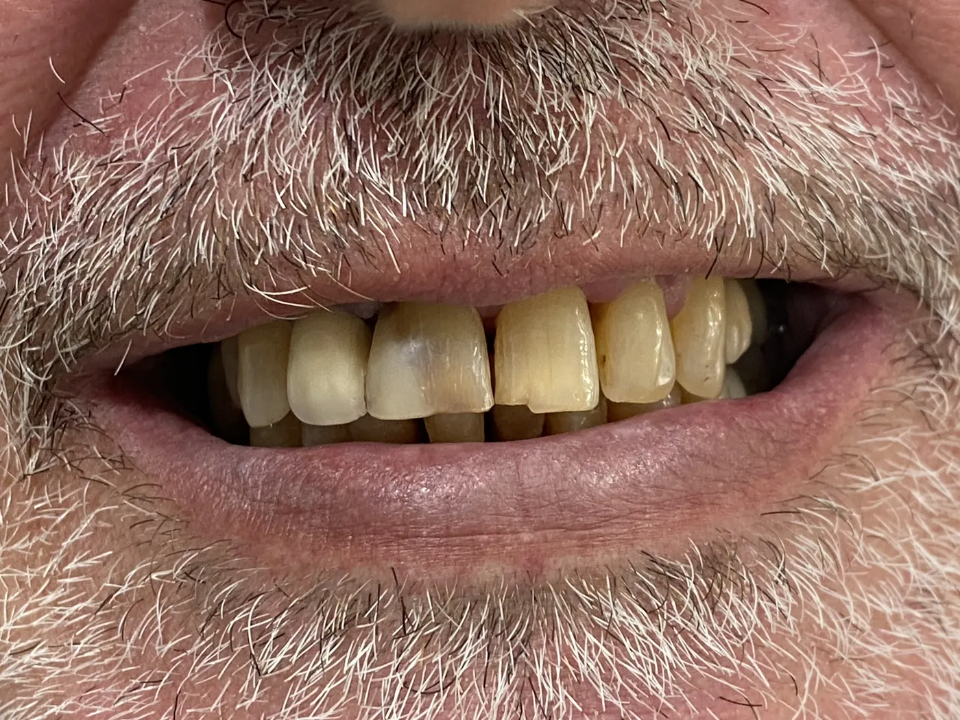 Antes: Caso 29