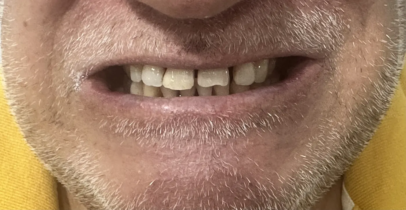 Antes: Caso 37